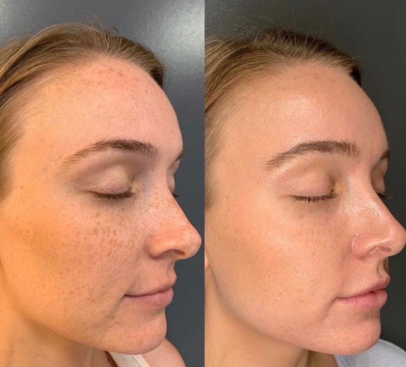 BB Glow Viso, Hello Beauty Roma