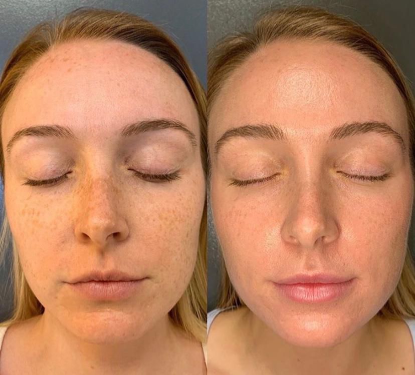 BB Glow Viso, Hello Beauty Roma