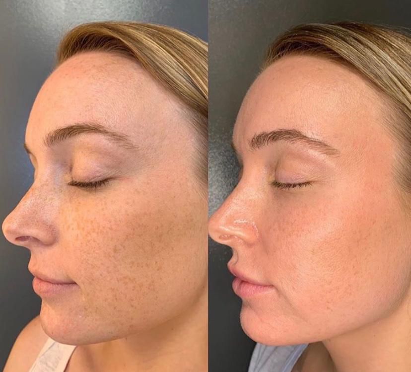 BB Glow Viso, Hello Beauty Roma