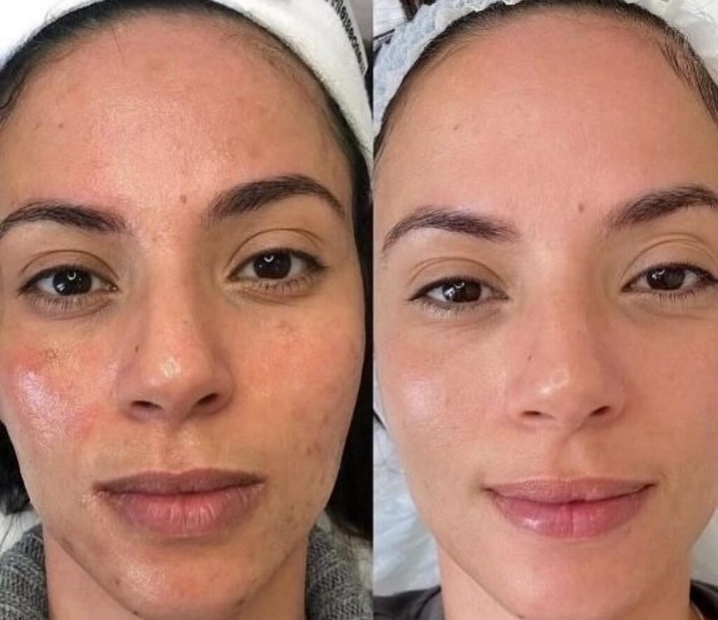 BB Glow Viso, Hello Beauty Roma