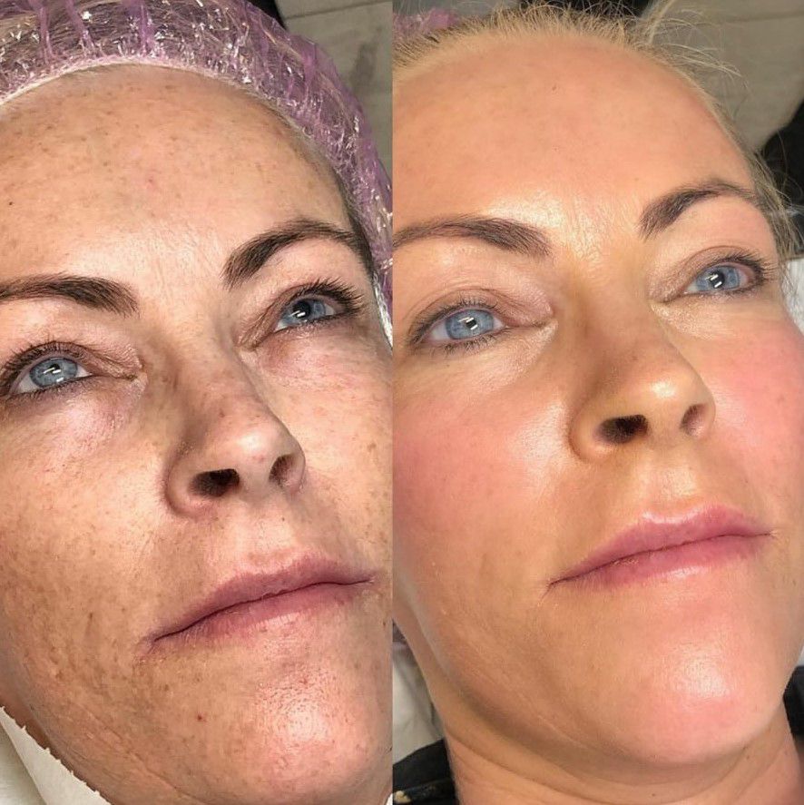BB Glow Viso, Hello Beauty Roma