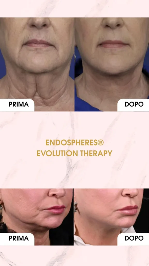 Endospheres Therapy, Hello Beauty Roma