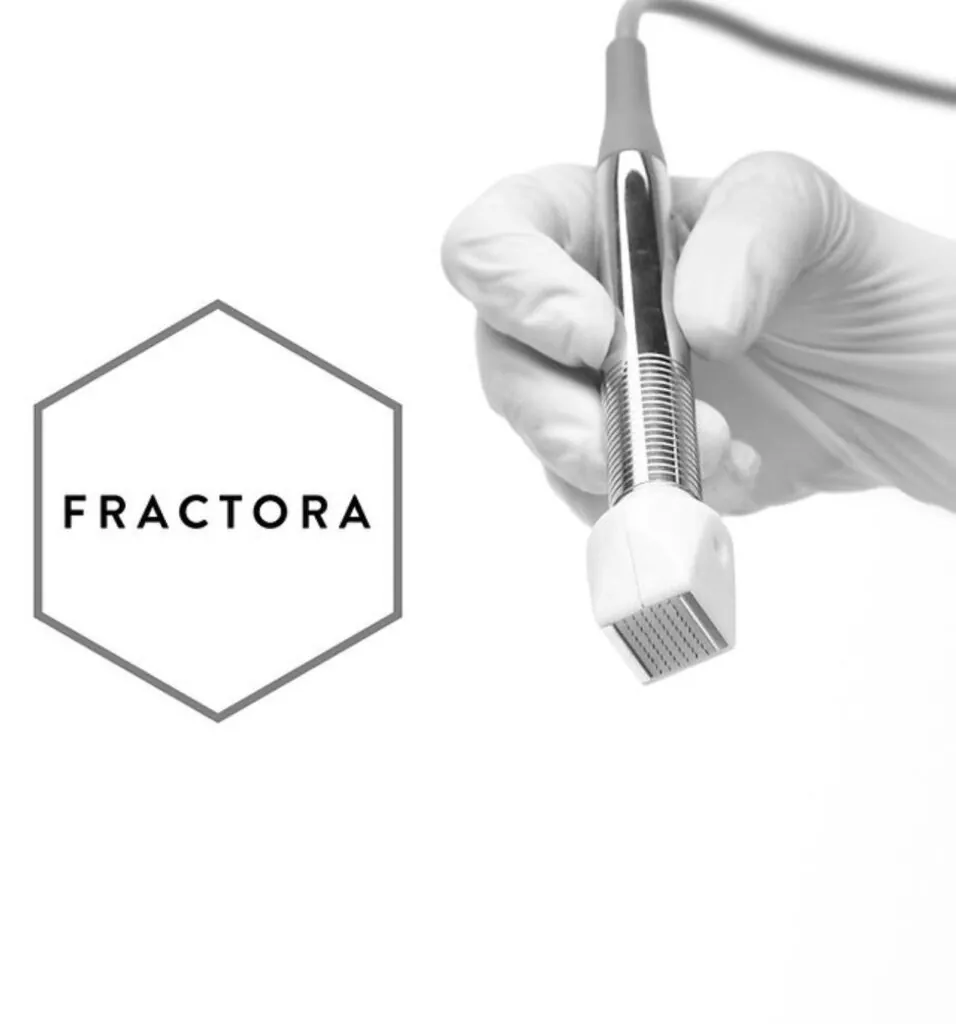 RF Lifting Fractora Roma, Hello Beauty Roma